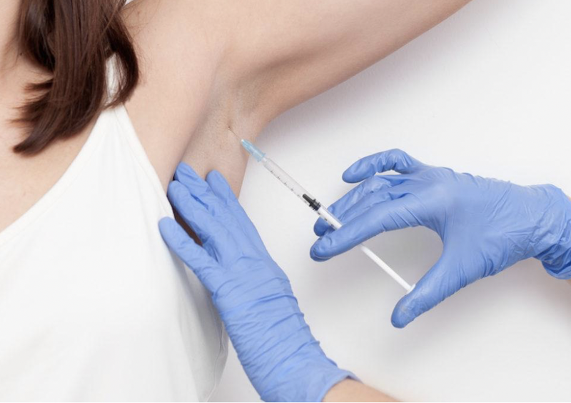 Sudoración excesiva Medellin Botox